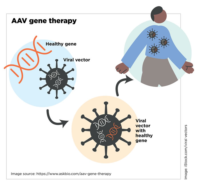 AAV Gene Therapy