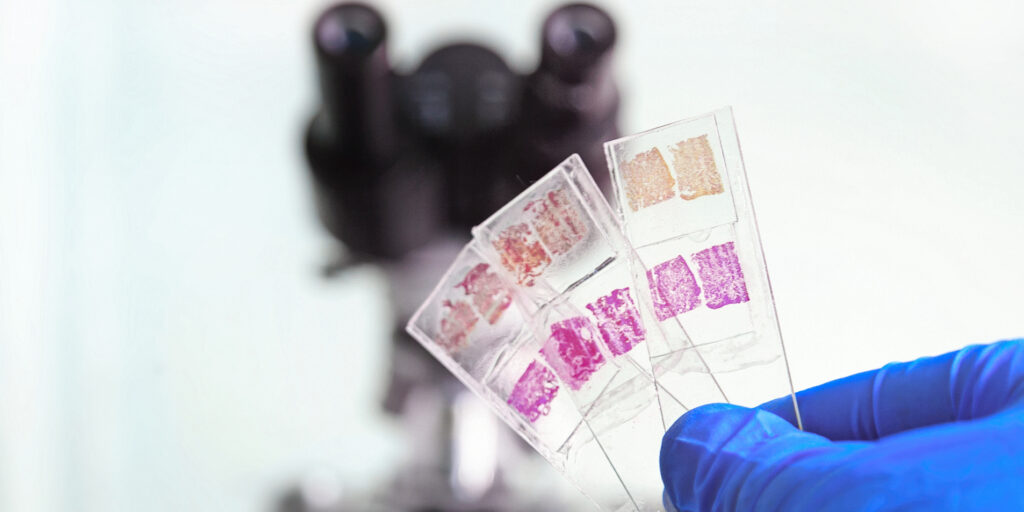 Glass slides in the laboratory. Hand in blue glove holding glass organ samples. Histological examination. The microscope in the background blurred. Pathologist at work.