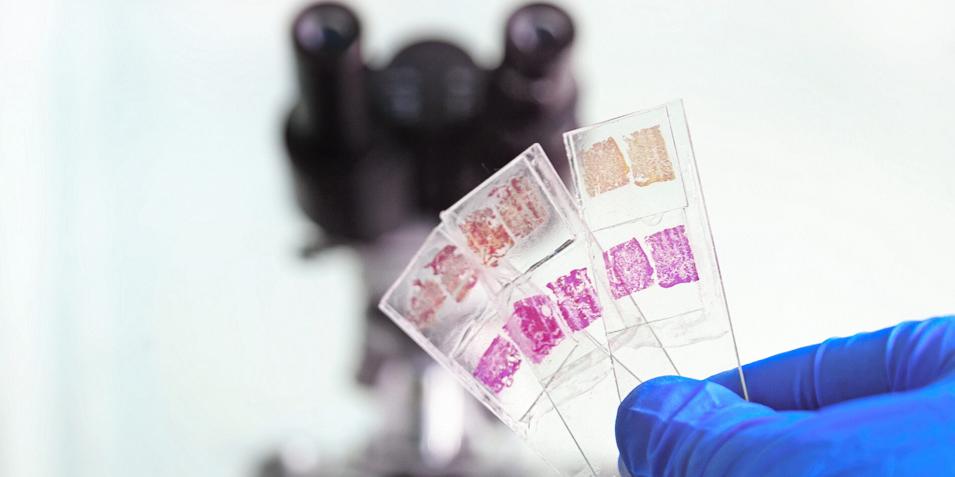 Glass slides in the laboratory. Hand in blue glove holding glass organ samples. Histological examination. The microscope in the background blurred. Pathologist at work.