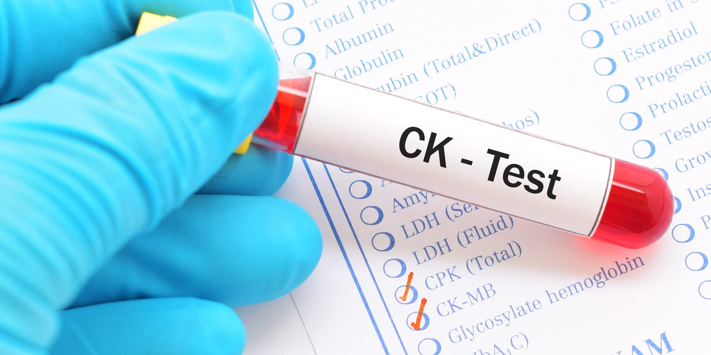 Blood sample with requisition form for creatine kinase (CK) test