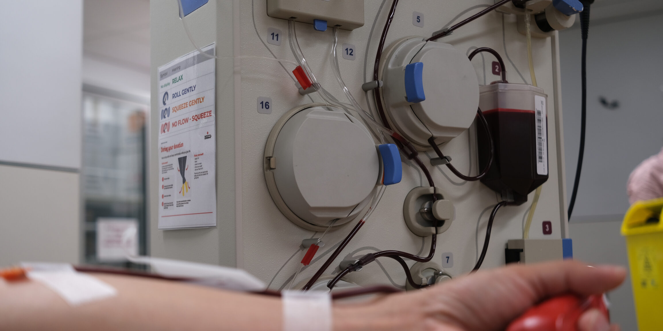 Plasma donor on Aurora Plasmapheresis System machine.