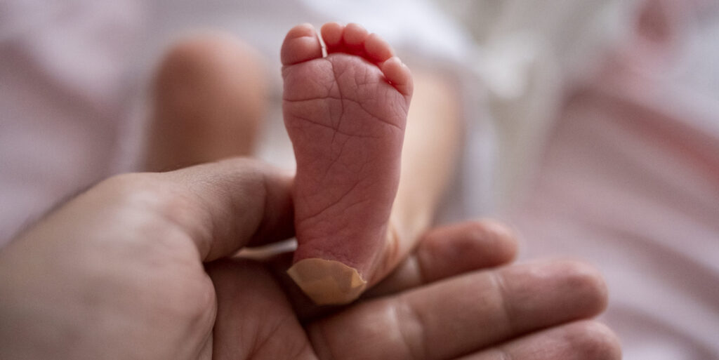 Newborn heel prick test and lood puncture, Taking a Heel Blood Sample From Newborn Baby