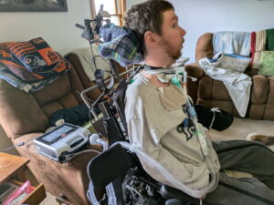 Jonathan Blaser has a tracheostomy that allows a tube to be placed in the trachea to deliver air from a ventilator.