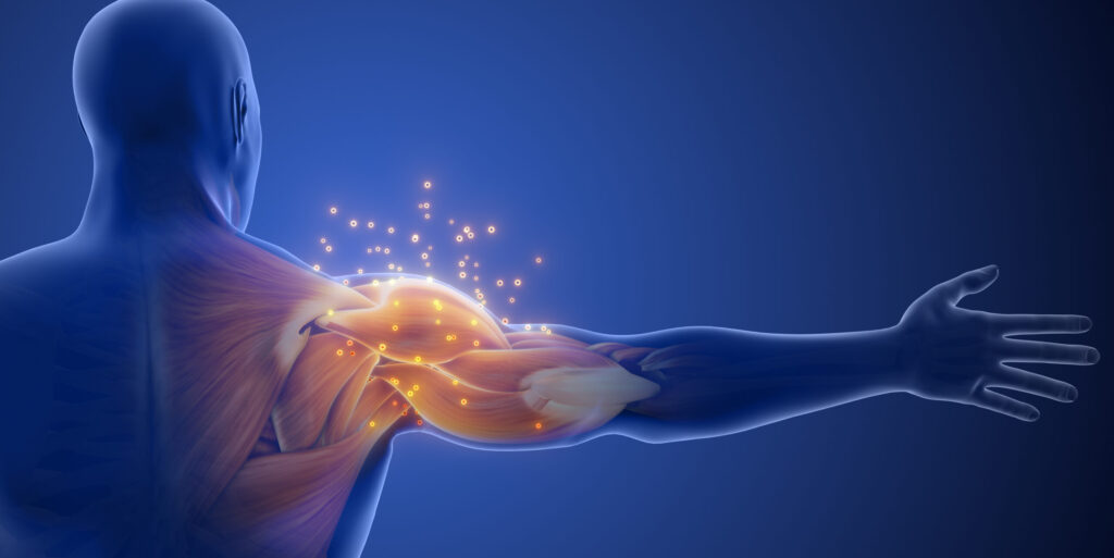 What Causes Tingling or Burning Shoulder Pain? Nerve damage or compression can cause burning in the shoulders. Conditions such as pinched nerves, herniated discs, or nerve damage due to diabetes or other medical conditions can cause this symptom.